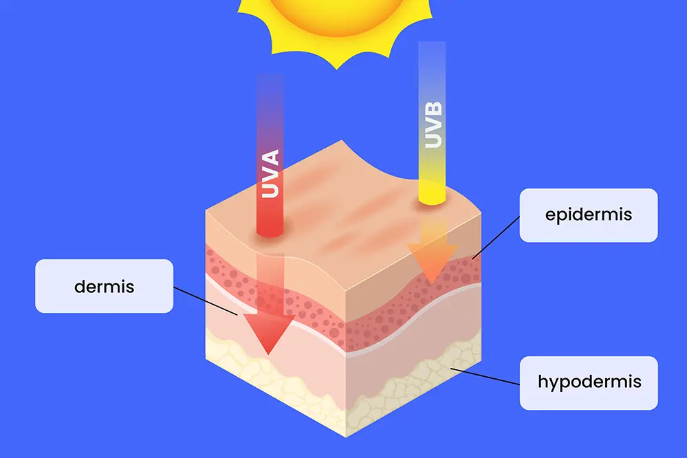 UVB and Skin Damage Risks